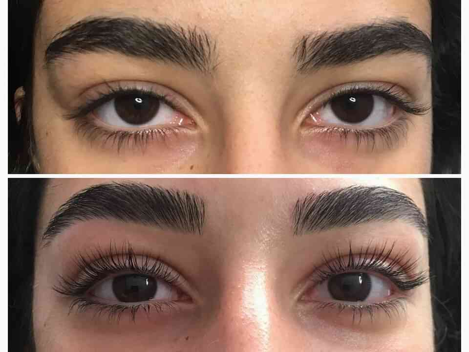Kirpik Lifting Uygulaması